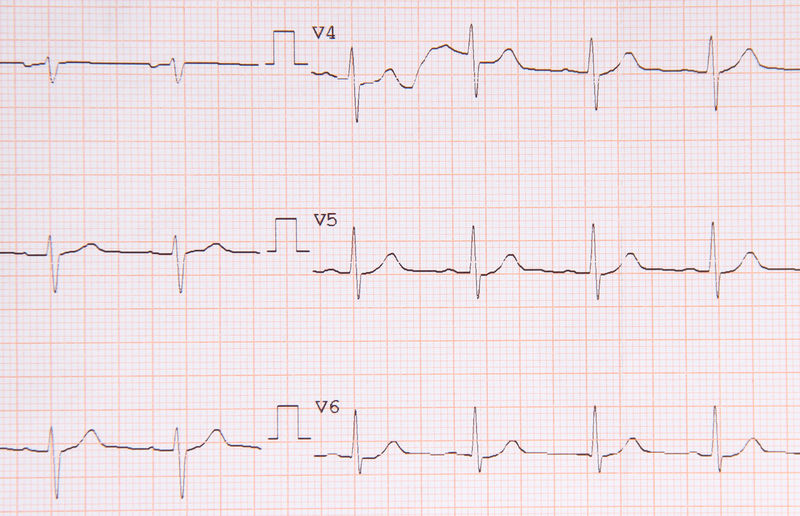 Full frame shot of ecg report