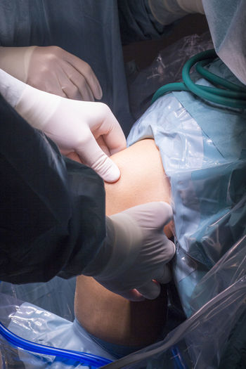 Midsection of doctors performing operation on patient knee in hospital