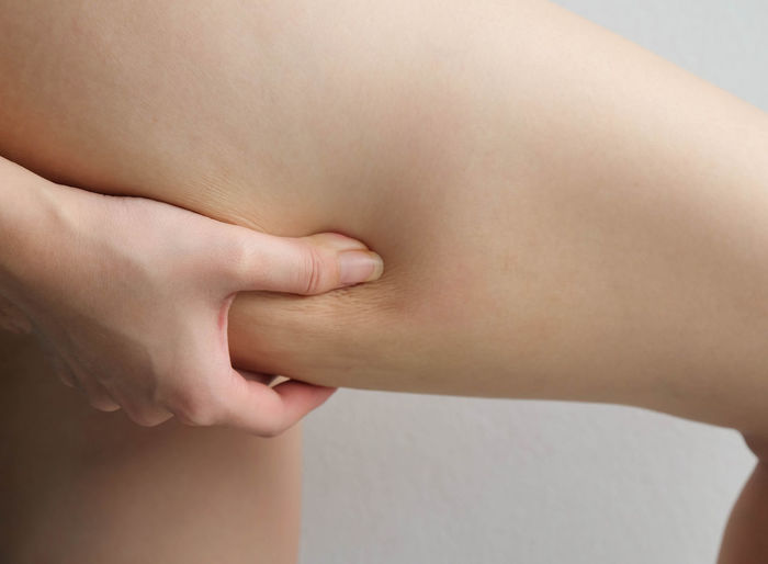 Cropped image of woman pinching thigh