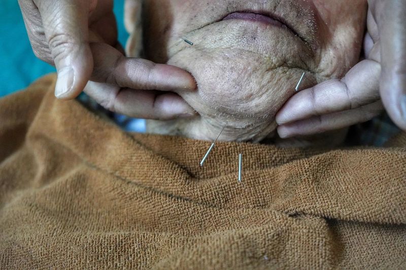 Close-up of cropped hands holding senior man with acupressure needles
