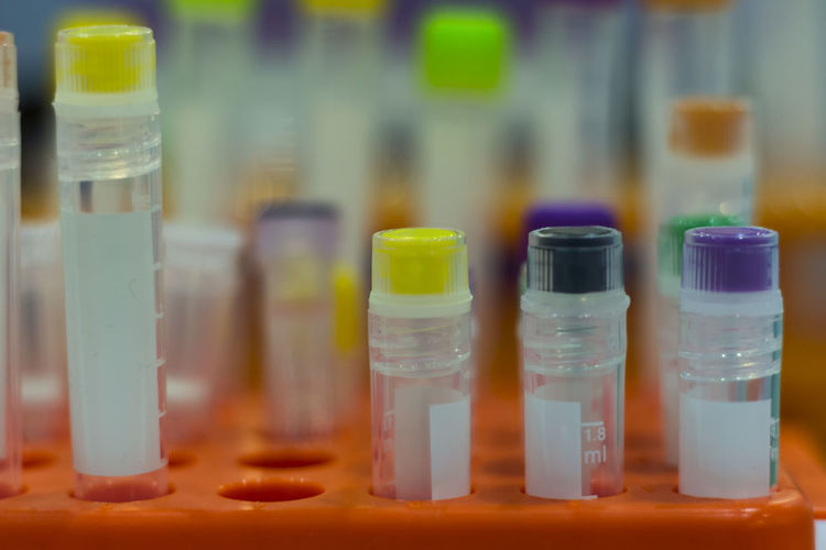 Close-up of samples in test tube rack