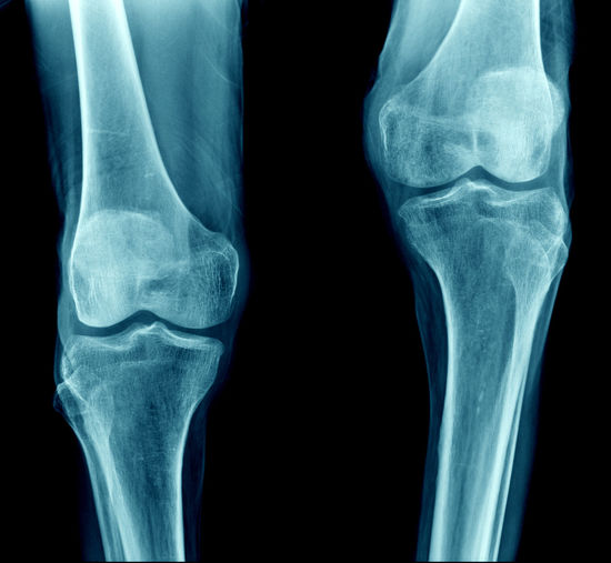 Full frame shot of x-ray