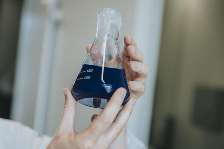 Woman hand holding blue liquid solution at clinic