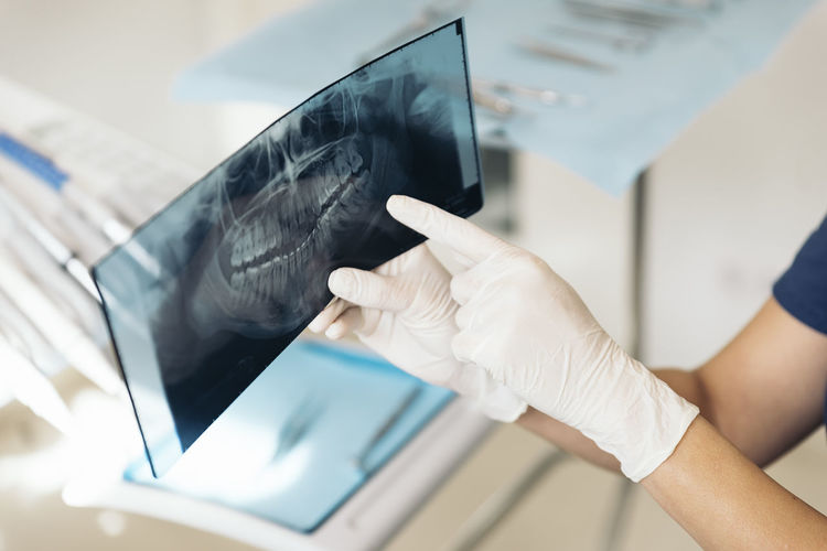 Cropped hands of dentist examining x-ray