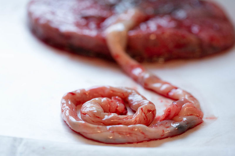 Close up of umbilical cord still attached to placenta visible vessels.