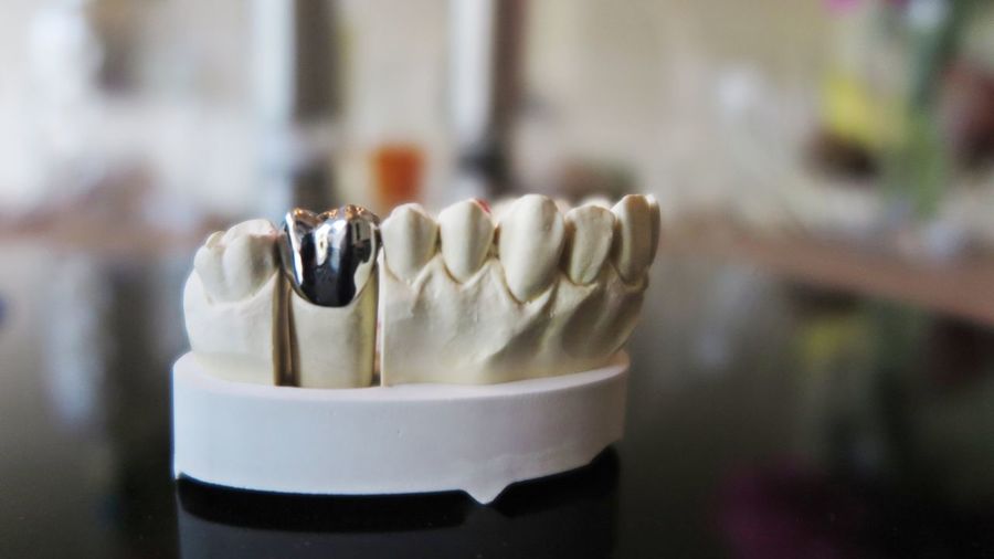 Close-up of dentures on table