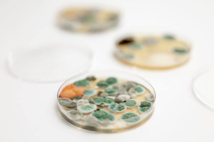 Mold samples on white background. a petri dish with colonies of microorganisms 
