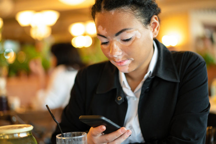 Woman african ethnicity with vitiligo sitting restaurant close up portrait  woman  skin problems.