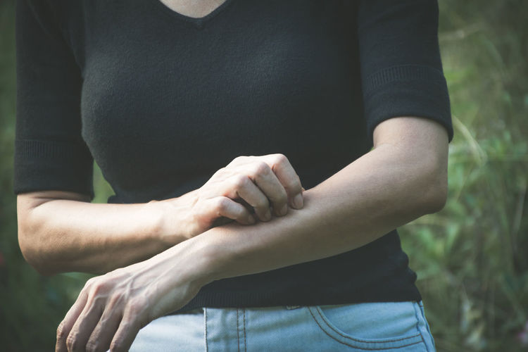 Midsection of woman scratching hand while standing outdoors