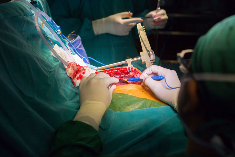 Doctors performing surgery on patient in operating room