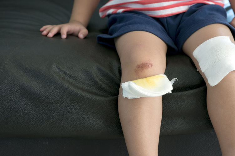 Midsection of boy showing wound while sitting on sofa with bandage on knees