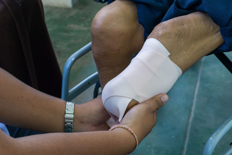 Cropped hand of doctor wrapping bandage on prosthesis leg in hospital