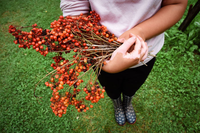 Vitiligo affected young girl standing and holding viburnum opolus red berries in her hands. autumn 