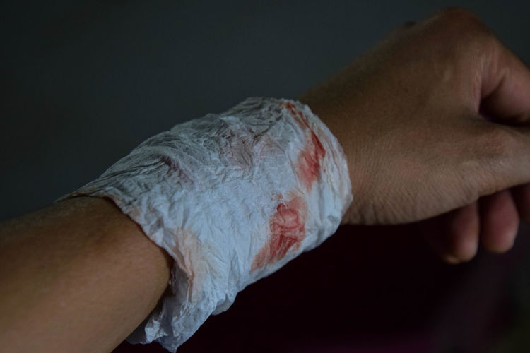 Close-up of cropped injured hand wearing adhesive bandage