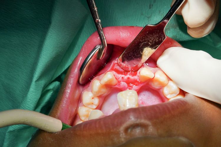 Cropped image of dentist examining teeth